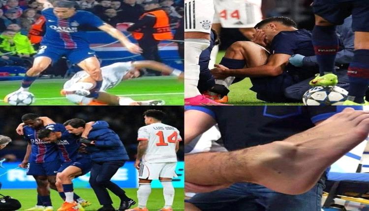 غياب طويل .. باريس يكشف تفاصيل إصابة حكيمي 