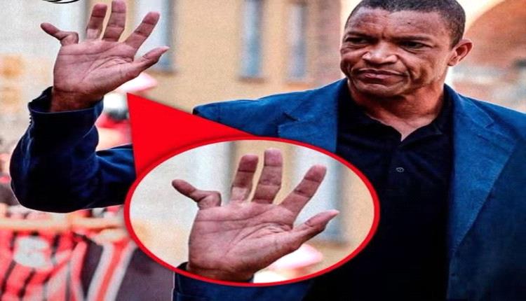 
بإصبع مكسور.. ظهور صادم لديدا أسطورة ميلان والبرازيل